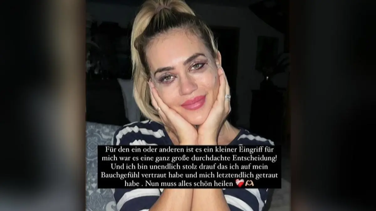 Jessica Haller ist stolz auf sich, den Eingriff gewagt zu haben. Das Resultat muss noch abheilen.