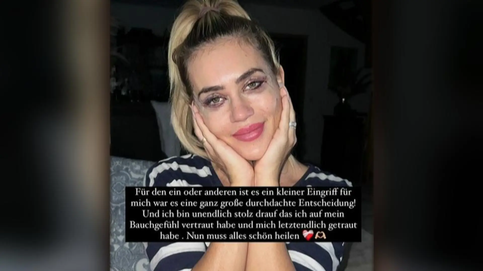 Jessica Haller ist stolz auf sich, den Eingriff gewagt zu haben. Das Resultat muss noch abheilen.