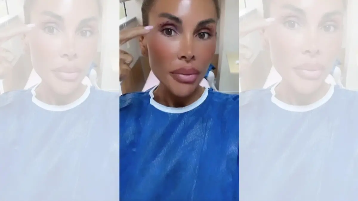 Lisha savage lässt sich beim Beauty-Doc in der Türkei ihre Hohlaugen unterspritzen.