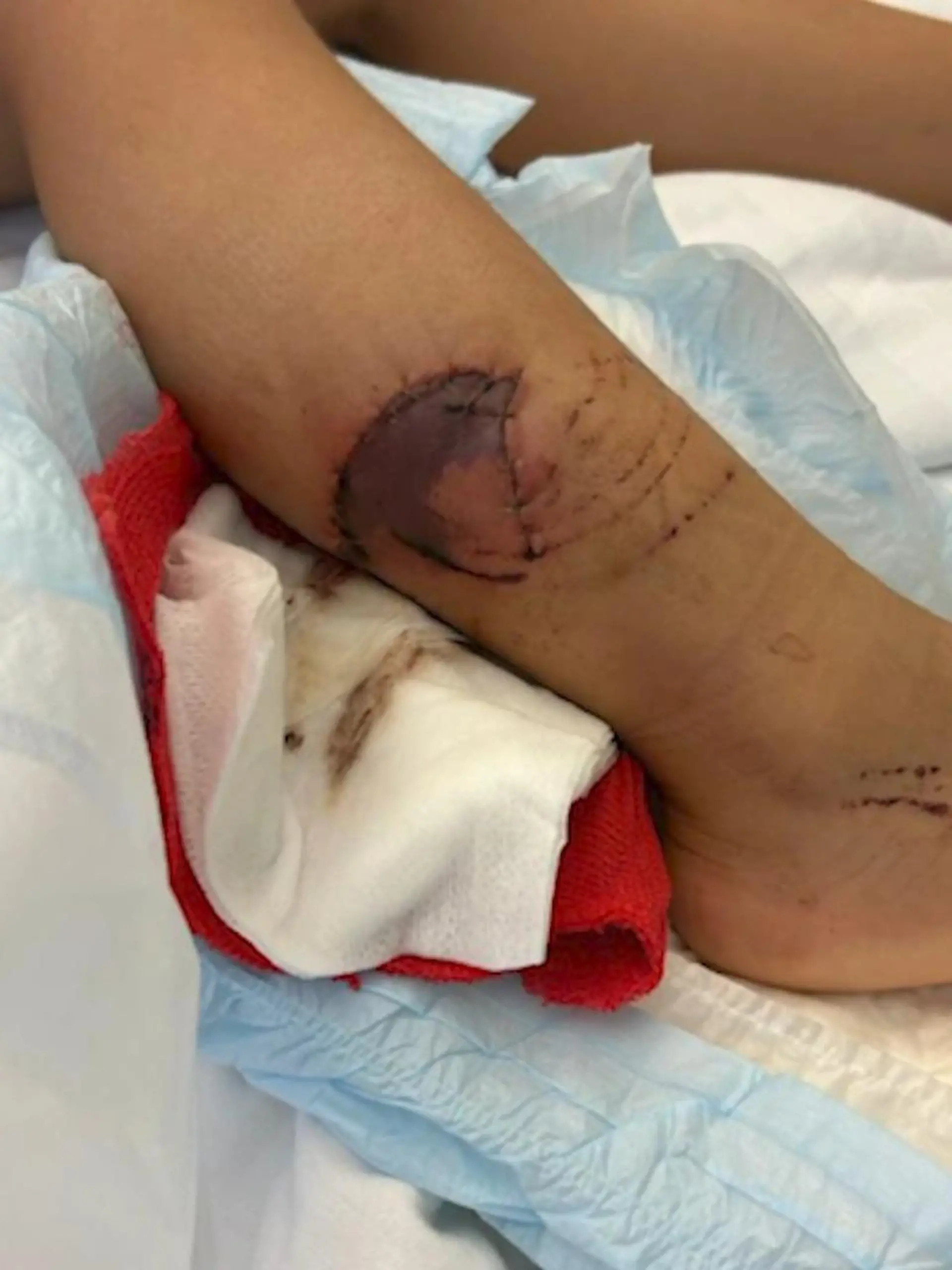 Bild zu: "Hunde greifen Vierjährige an"