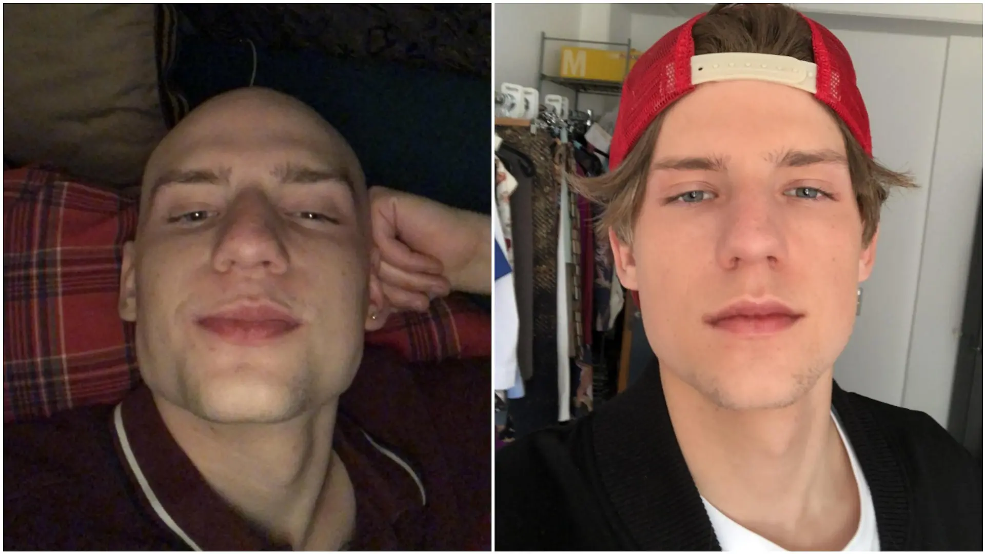 Kurze Zeit nach seiner Chemotherapie rasierte sich Lennart Borchert die Haare. Bei GZSZ trug er dann eine Perücke, meistens mit Kappe.