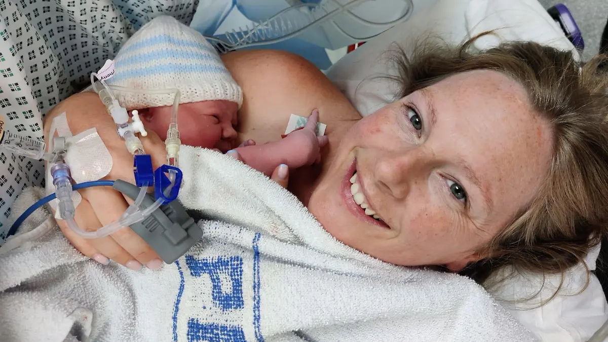 Story from Jam Press (Baby Without Bum) 

Pictured: Vickie after giving birth to her son, Charlie.

Doctors discover rare defect after a baby is born without BUM

A mum has shared the harrowing story of her baby being born without a bum – with the toddler undergoing six life-saving surgeries before his first birthday.

When Vickie Thompson and her fiancé, Alex, 37, gave birth to her son, Charlie, she was over the moon and at first had no idea that anything was amiss.

But just a few hours later, while still in hospital and unable to wake her child, who was in a cot next to her, the mum began to panic.

That’s when medical professionals reportedly discovered the child did not have a bum hole opening and immediately rushed the child to have his stomach pumped.

“I was absolutely petrified... I thought he was dying,” the 36-year-old beauty therapist from West Sussex, told Jam Press.

“The doctors said, ‘We don’t think he has an opening’.

“I was so scared.”

Having fed the newborn just a few hours prior to the shocking discovery, Vickie had also noticed her son had not yet pooped and his pee was a strange green colour.

Upon further investigation, doctors confirmed he had an imperforate anus, the narrowing or absence of the bum, a condition which affects one in 5,000 babies.

Whisking Charlie to the Neonatal Intensive Care Unit (NICU), the doctors removed the contents of his stomach to ensure no toxins remained.

The next day, he was transferred from Worthington Hospital to Brighton Hospital to have a stoma created, placing him under more specialist care.

A stoma is an opening in the abdomen connected to your digestive system, diverting waste away from the bowels and out of the body.

Charlie spent three days in the NICU after the major operation, two of which were in a coma.

The mum said: “I was petrified I was going to lose him.

“They had to put him on life support and I kept thinking he was going to die.

“I kept thinking the worst.”
