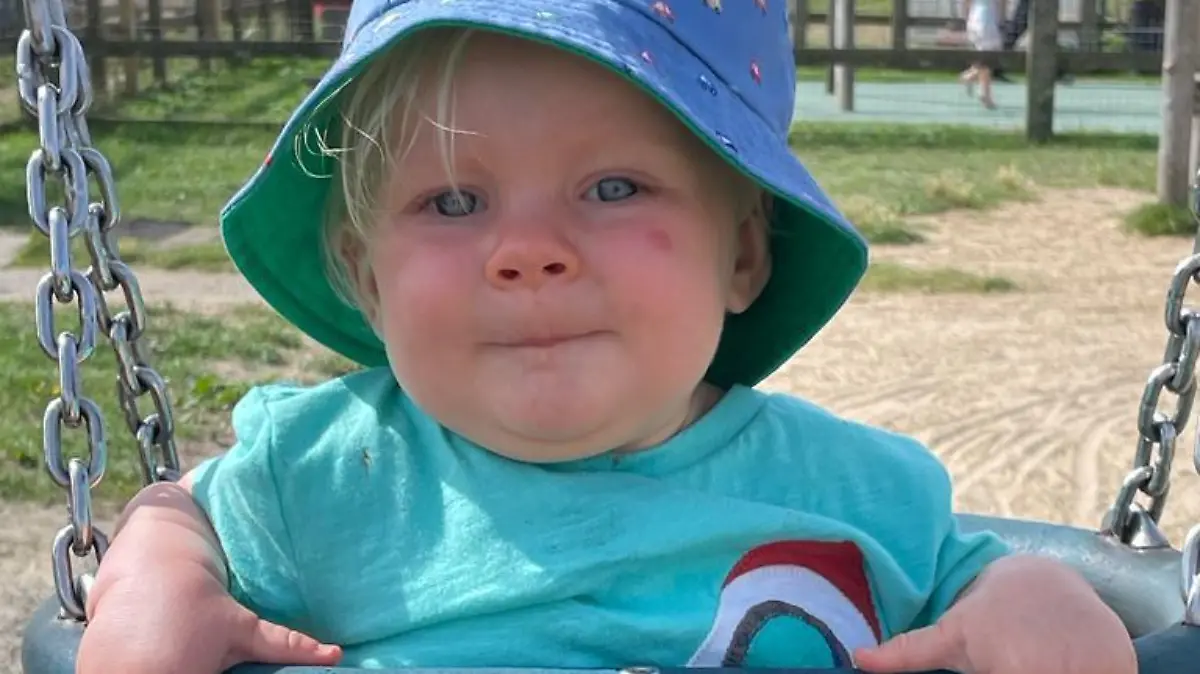 Story from Jam Press (Baby Without Bum) 

Pictured: Charlie.

Doctors discover rare defect after a baby is born without BUM

A mum has shared the harrowing story of her baby being born without a bum – with the toddler undergoing six life-saving surgeries before his first birthday.

When Vickie Thompson and her fiancé, Alex, 37, gave birth to her son, Charlie, she was over the moon and at first had no idea that anything was amiss.

But just a few hours later, while still in hospital and unable to wake her child, who was in a cot next to her, the mum began to panic.

That’s when medical professionals reportedly discovered the child did not have a bum hole opening and immediately rushed the child to have his stomach pumped.

“I was absolutely petrified... I thought he was dying,” the 36-year-old beauty therapist from West Sussex, told Jam Press.

“The doctors said, ‘We don’t think he has an opening’.

“I was so scared.”

Having fed the newborn just a few hours prior to the shocking discovery, Vickie had also noticed her son had not yet pooped and his pee was a strange green colour.

Upon further investigation, doctors confirmed he had an imperforate anus, the narrowing or absence of the bum, a condition which affects one in 5,000 babies.

Whisking Charlie to the Neonatal Intensive Care Unit (NICU), the doctors removed the contents of his stomach to ensure no toxins remained.

The next day, he was transferred from Worthington Hospital to Brighton Hospital to have a stoma created, placing him under more specialist care.

A stoma is an opening in the abdomen connected to your digestive system, diverting waste away from the bowels and out of the body.

Charlie spent three days in the NICU after the major operation, two of which were in a coma.

The mum said: “I was petrified I was going to lose him.

“They had to put him on life support and I kept thinking he was going to die.

“I kept thinking the worst.”

After seven days, Vickie was able to 