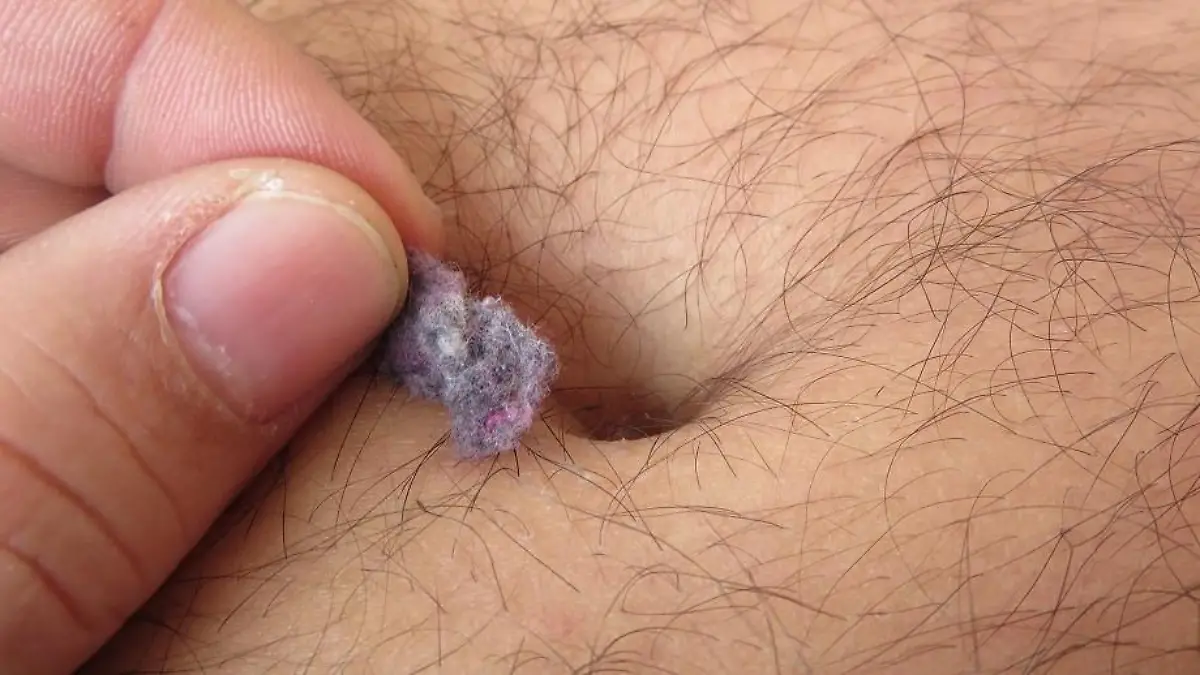 Ein behaarter Mann zieht bunte Fusseln aus seinem Bauchnabel.