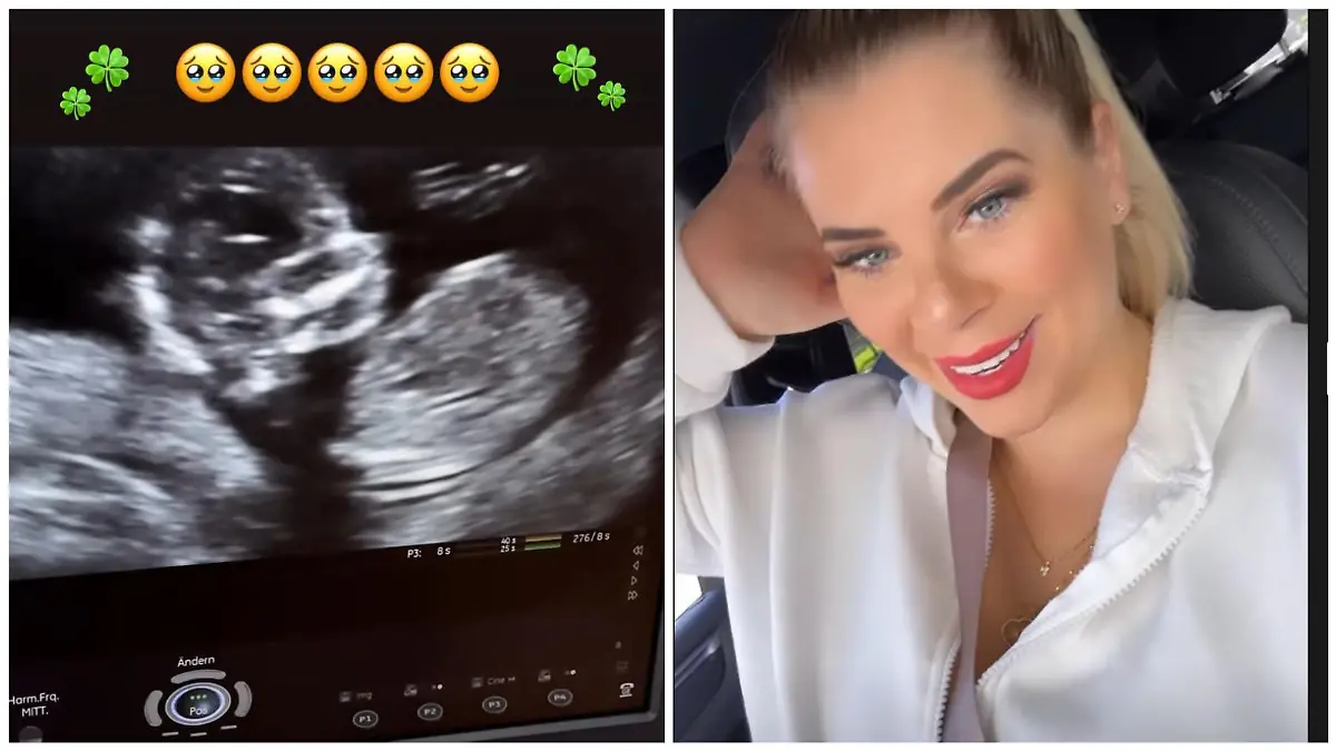 Jenny Frankhauser zeigt die Ultraschallbilder ihres zweiten Kindes
