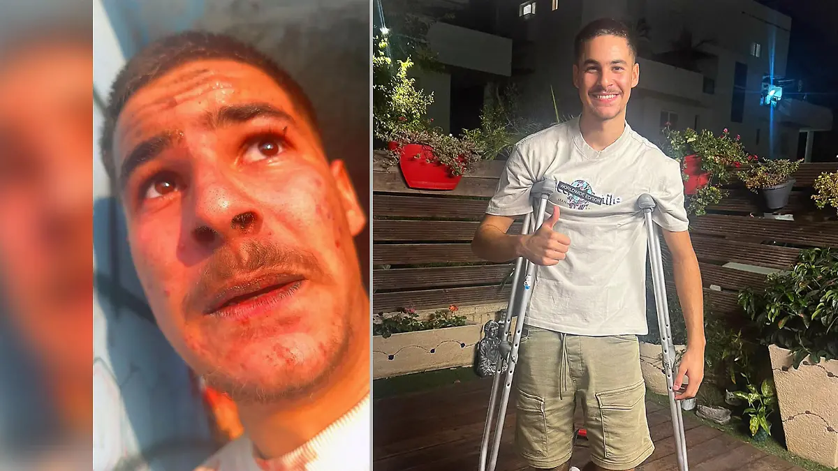 Links: Ein Selfie von Noam Cohen am Morgen nach dem Massaker (Foto: Privat/dpa). Rechts: Cohen nach seiner Rückkehr aus dem Krankenhaus (dpa Bildfunk)