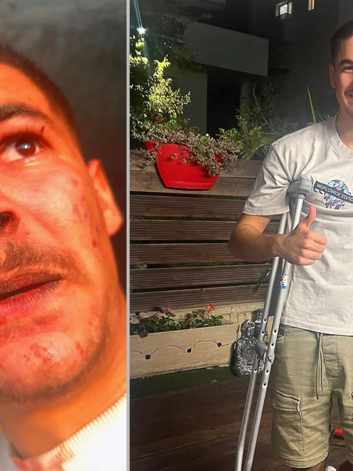 Links: Ein Selfie von Noam Cohen am Morgen nach dem Massaker (Foto: Privat/dpa). Rechts: Cohen nach seiner Rückkehr aus dem Krankenhaus (dpa Bildfunk)