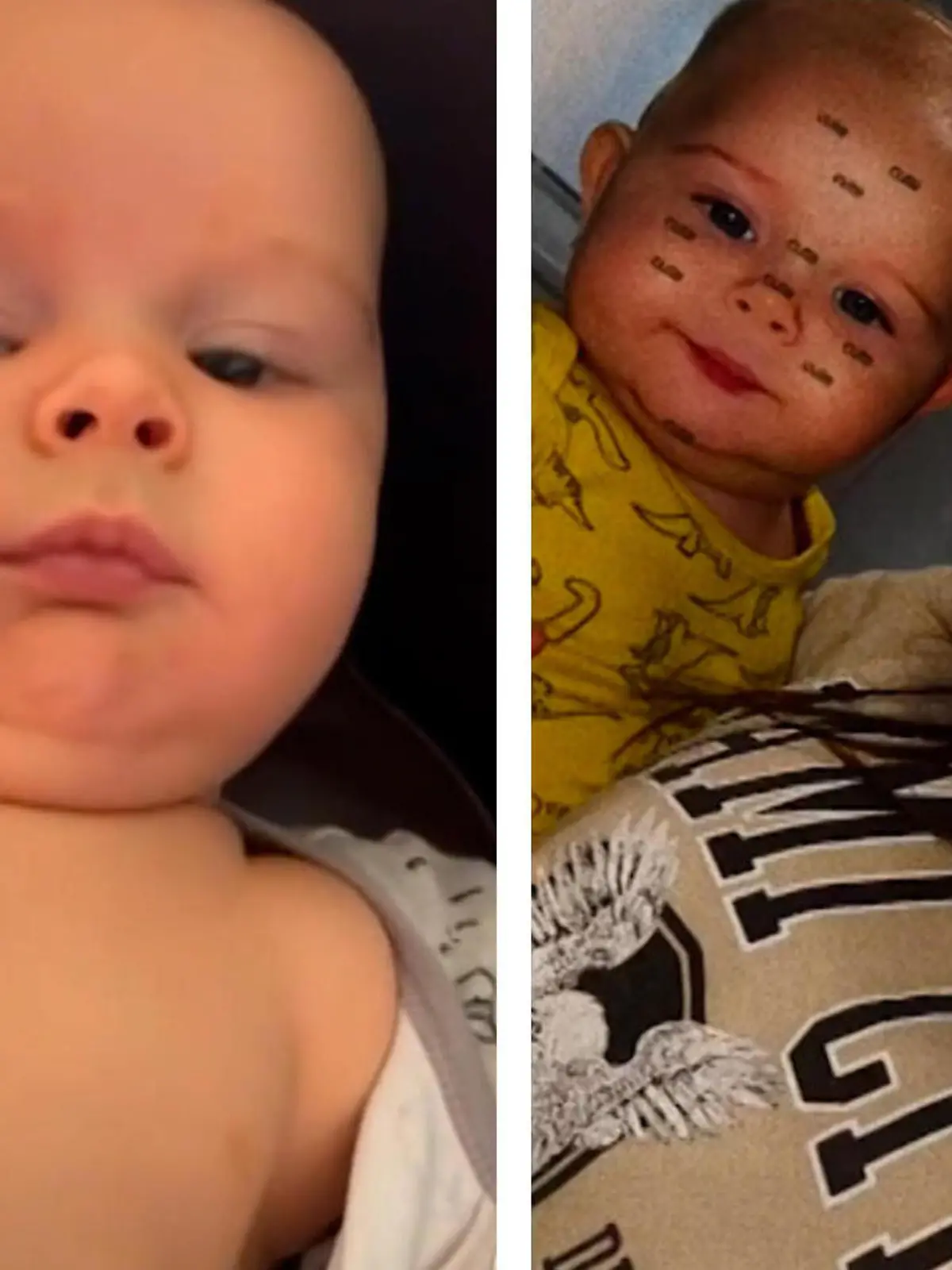 Als der kleine Mateo mit einem Mal keine Luft mehr bekommt und seine Haut fleckig wird, ahnt Mama Jasmine Stevens Böses. Eine Mutter in einer Facebook-Gruppe hatte zuletzt über die tödlichen Symptome einer Sepsis berichtet - und die ähneln gefährlich denen von Mateo!
