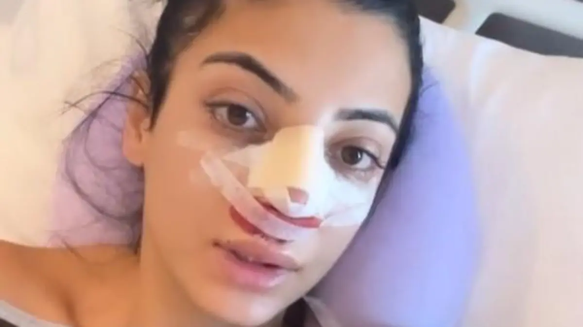 Dilara Kruse hat sich in der Türkei eine Schönheits-OP unterzogen.