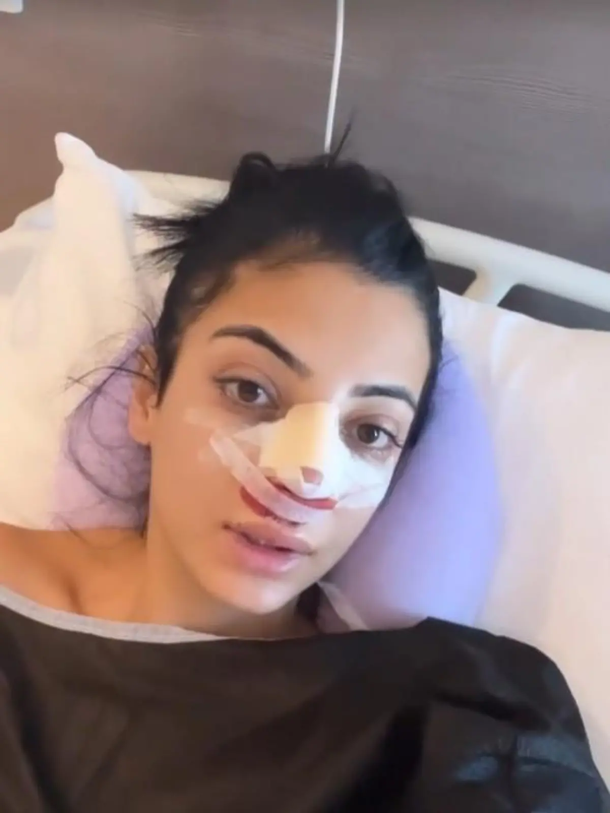 Dilara Kruse hat sich in der Türkei eine Schönheits-OP unterzogen.