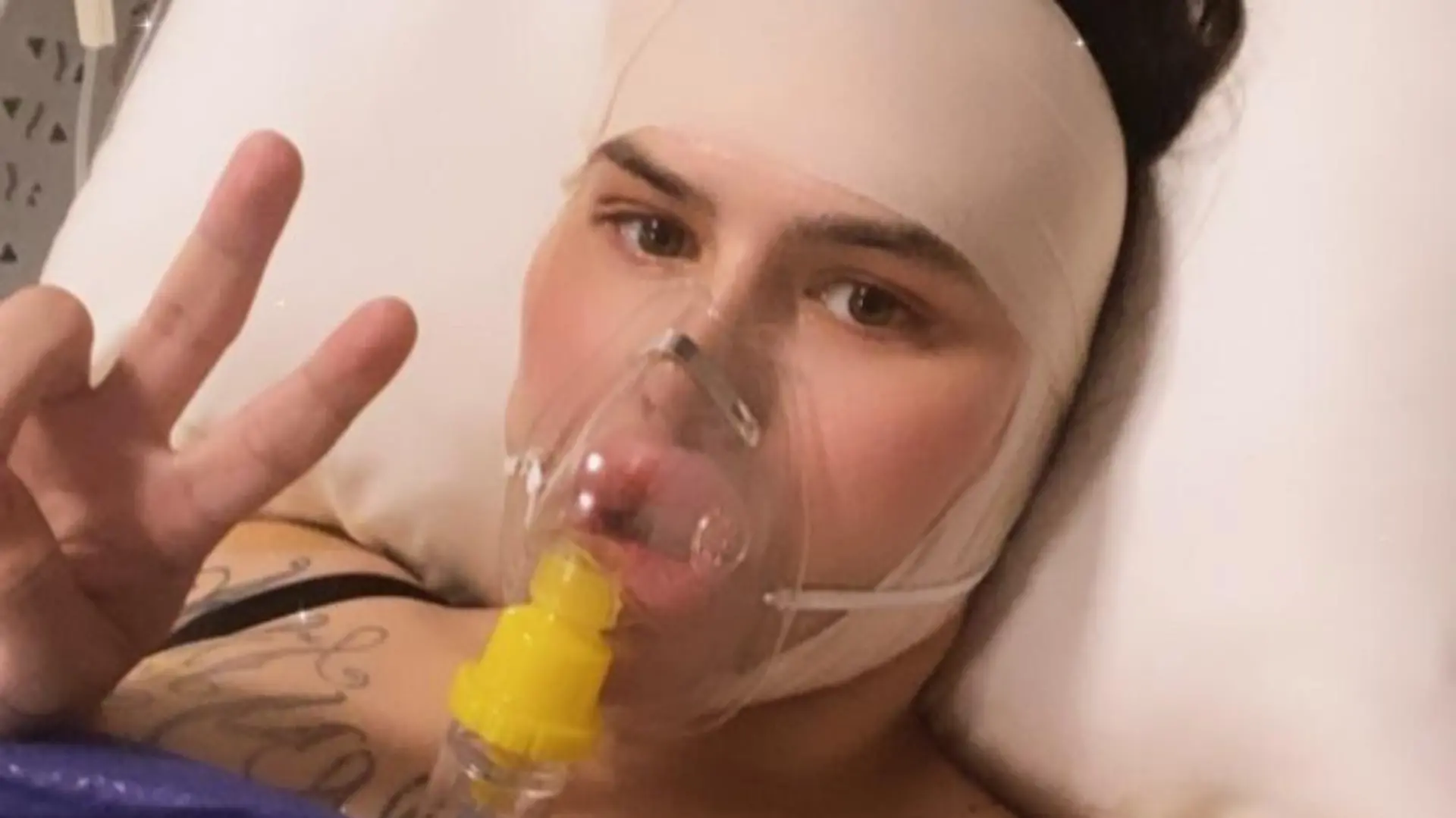 Story from Jam Press (Near Fatal BBL) 

Pictured: Sofia in hospital after going through surgery.

Woman left unable to sit for 15 WEEKS after 'near-fatal' BBL

A model claims she nearly died after spending £12,000 on a BBL in Turkey.

Sofia Lips, 27, a content creator, decided to get a Brazilian butt lift (BBL), wanting to achieve an hourglass shape.

Sofia – who previously made headlines for having Britain’s largest lips – flew to Turkey for the surgery, and claims began vomiting blood once she woke up after the op.

She claims she was flown back to the UK that day, with doctors rushing to drain the dangerous levels of fluid in her body.

Despite the 'near-fatal' incident, she says she would do it again, willing to risk her life to achieve the perfect body.

“The surgery itself went amazing, but I woke up after surgery throwing up blood,” Sofia, from Manchester, told NeedToKnow.co.uk.

“I instantly had to go to the airport because Turkey went into a red zone due to Covid in May 2021.

“There were no drains in my butt, so all the fluid was building up in me.

“The fluid was a build-up of pure blood because, after a BBL, you are fitted with drains for at least a few days, but I was woken up with nothing, no drains, no aftercare just in a faja [compression suit] being sent to an airport.

“I was totally on my own for the flight, everything.

“Just standing up was hard... I was so faint.

“I had a BBL pillow I had to sit on during take-off, then I stood the whole flight, crying behind my sunglasses until landing, [when I] sat back on my BBL pillow.

“Once I landed, I was so weak and fainting.

“I went straight home and started filling with fluid in my butt again, so I had to go to surgery at a hospital to drain it.”

After spending £2,000 to get home, Sofia was instantly rushed into surgery to drain the build-up of fluid.

Following the initial drain, she had to visit the doctors to be drained once a week for 11 weeks, each time costing he