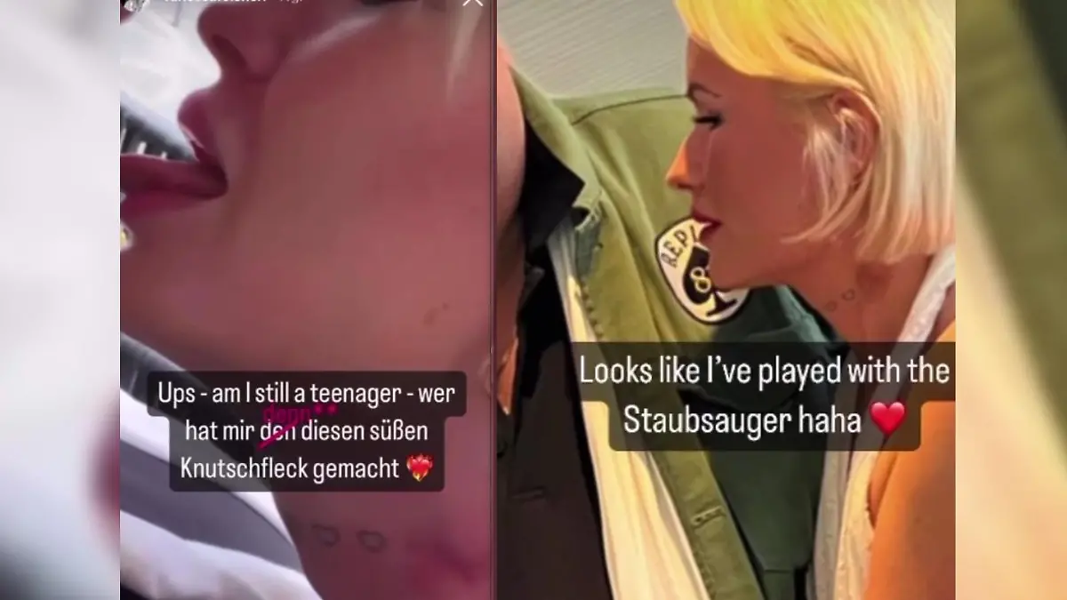 Vanessa Felsner zeigt einen großen Knutschfleck an ihrem Hals und schreibt, dass sie ich wie ein Teenager fühle.