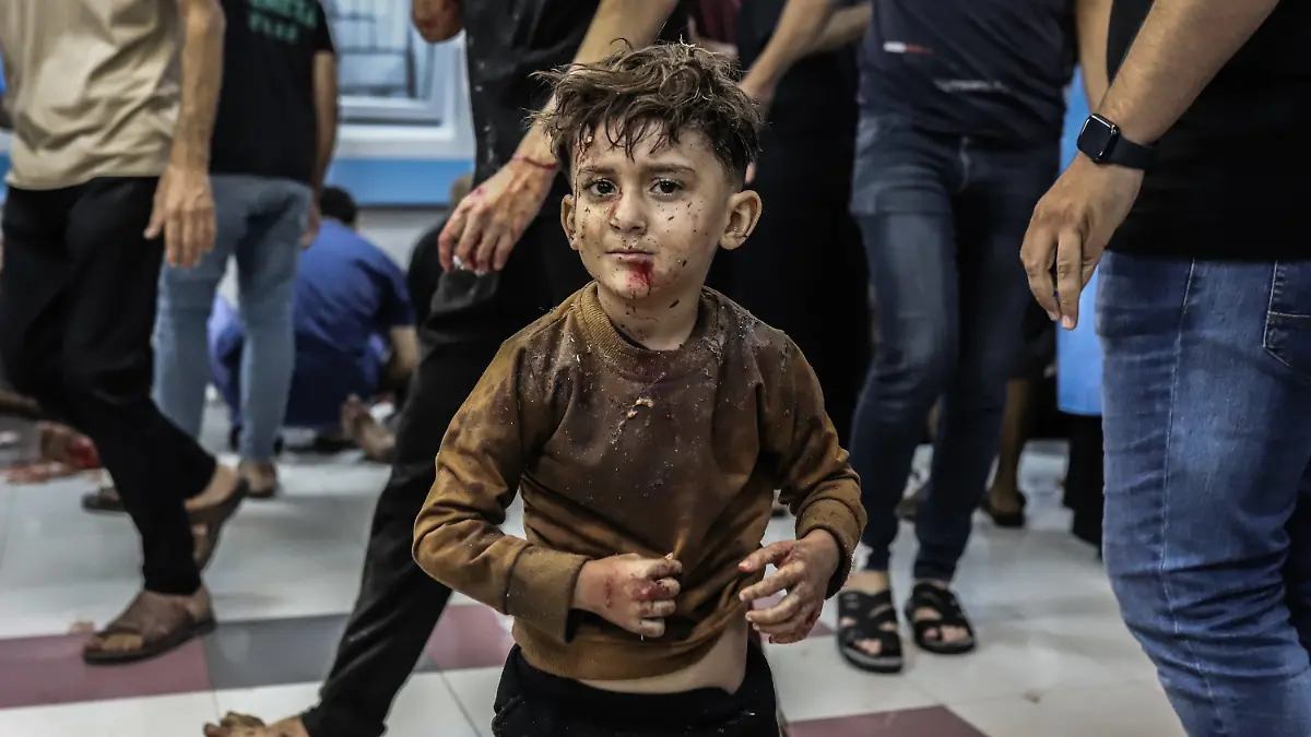 17.10.2023, Palästinensische Gebiete, Gaza-Stadt: Ein verletztes palästinensisches Kind wartet auf medizinische Versorgung im Al-Shifa Krankenhaus, nachdem es im Ahli Arab Krankenhaus im Gazastreifen bei einem Raketeneinschlag verletzt wurde. In dem Ahli Arab Krankenhaus waren nach Angaben des dortigen Gesundheitsministeriums durch einen Raketeneinschlag Hunderte Menschen getötet und verletzt worden. Die genaue Zahl der Todesopfer war zunächst unklar. Woher die Rakete kam und ob es sich um einen Irrläufer handelte ist ebenfalls unklar. Foto: Mohammad Abu Elsebah/dpa +++ dpa-Bildfunk +++