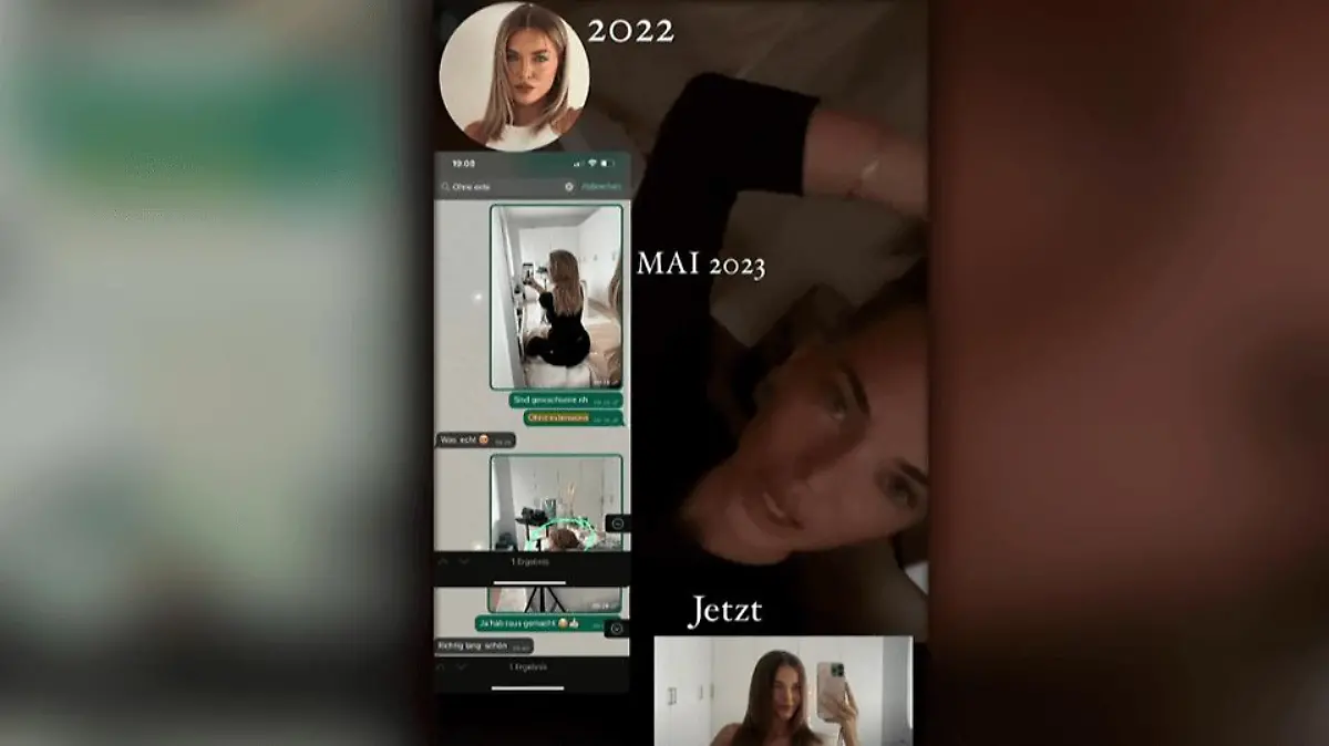 Laura Maria Rypa weiß sich in Sachen Haarwachstum zu helfen.