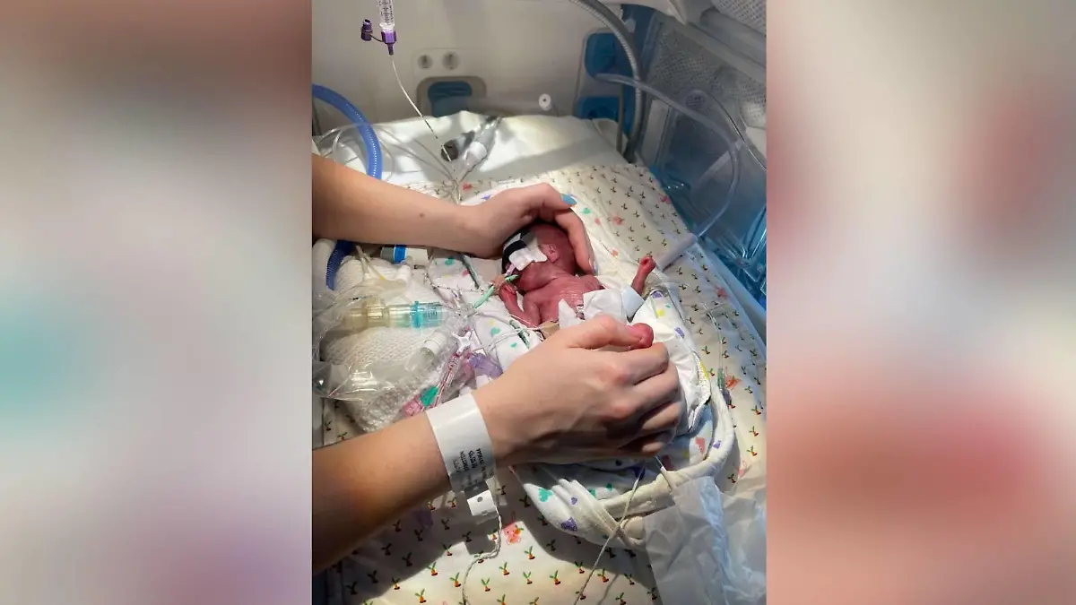 Baby Isla im Krankenhaus mit Beatmungsgeräten.