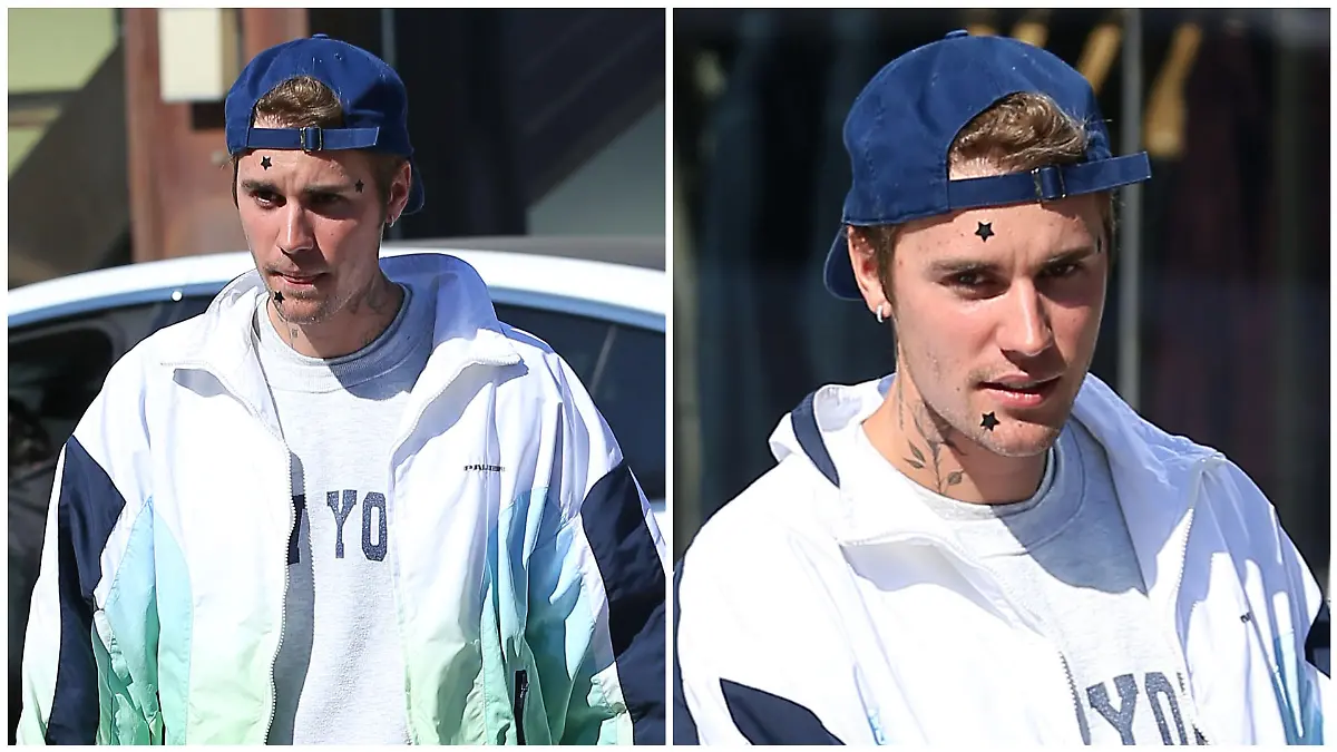 Justin Bieber: Woher kommen die Sterne auf seinem Gesicht?