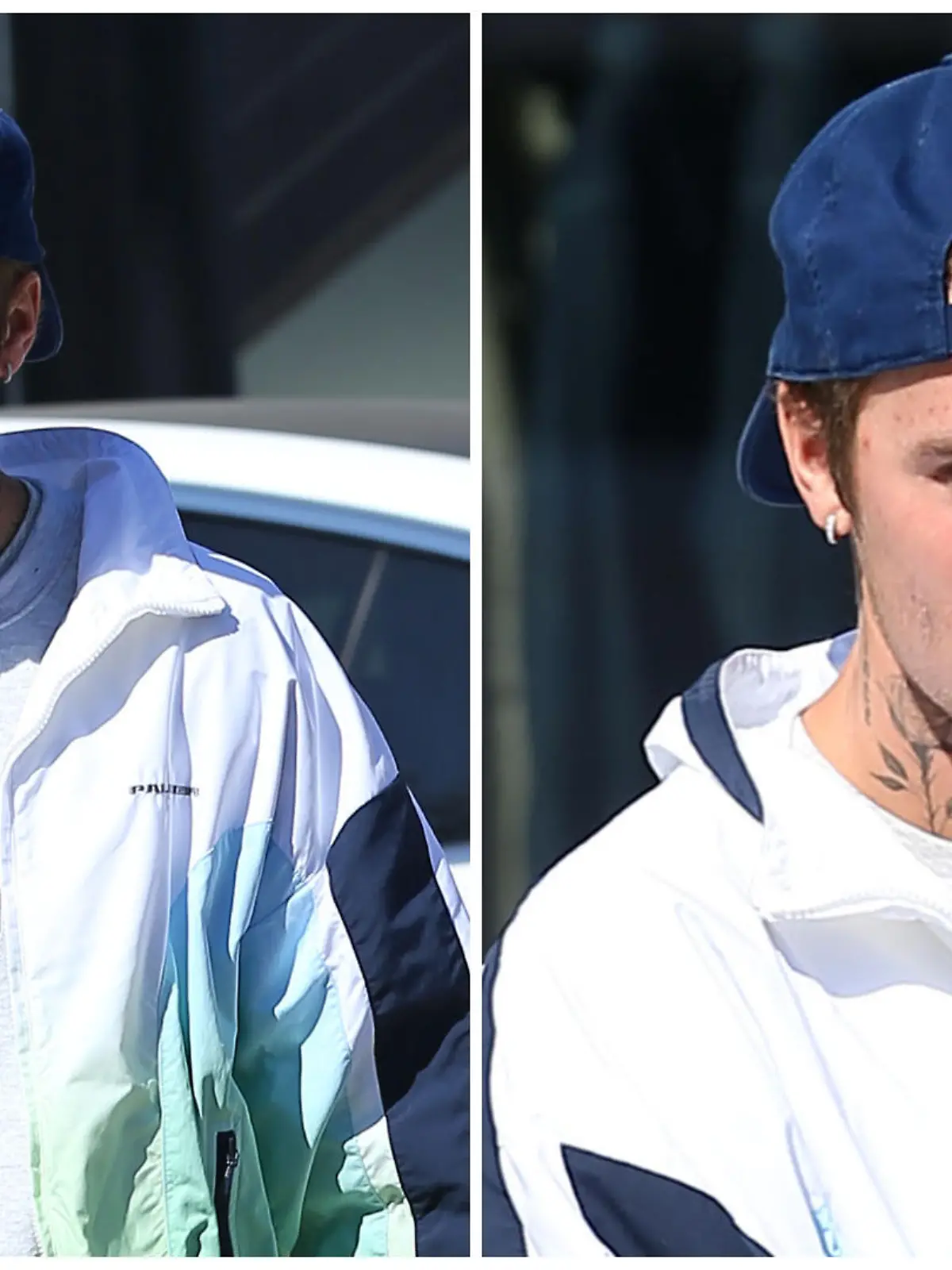 Justin Bieber: Woher kommen die Sterne auf seinem Gesicht?