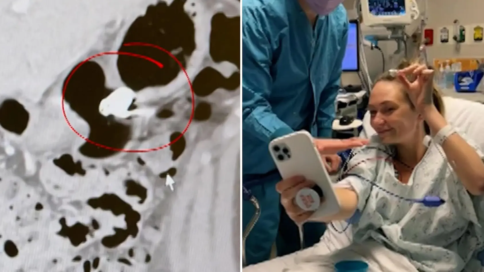 Frau verschluckt Kopfhörer