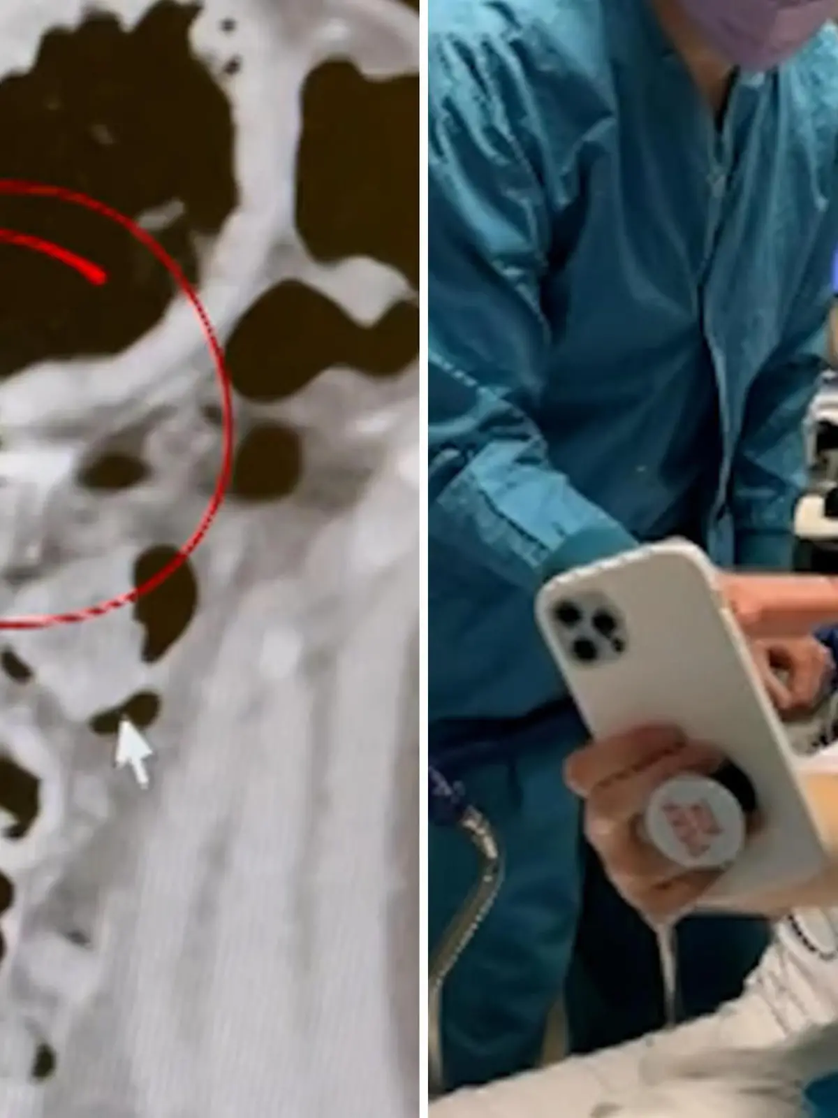 Statt in den Ohren landen die AirPods einer Amerikanerin in deren Magen! 
Viele technische Geräte werden immer kleiner. Dass das nicht immer ein Vorteil sein muss, hat jetzt auch Moe Kennedy aus Seattle erfahren. Denn sie hat unbemerkt einen ihrer Kopfhörer verschluckt. Mehr dazu im Video.
