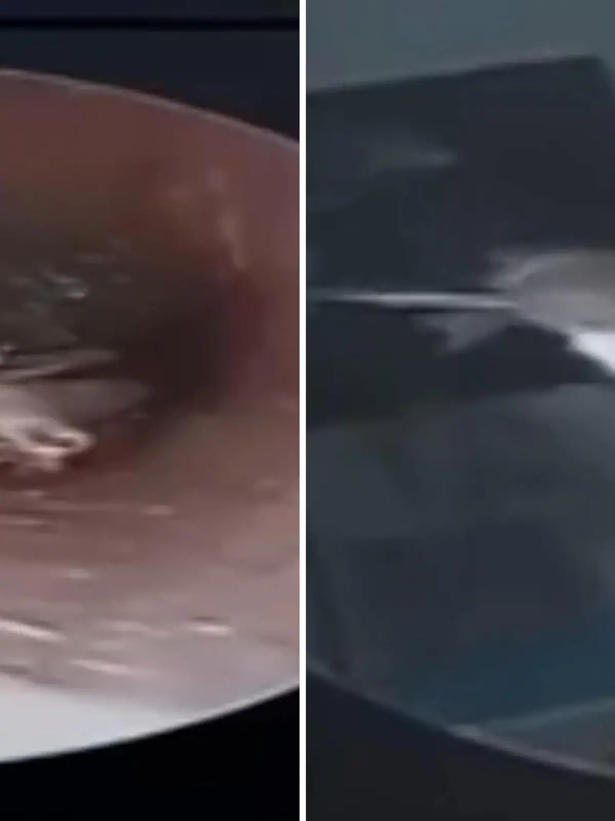 In Hanoi in Vietnam verirrt sich ein Schmetterling in den Gehörgang eines Mannes. Der klagt über Schmerzen, hat aber keine Ahnung, was da genau in seinem Ohr los ist. Mehr dazu im Video.