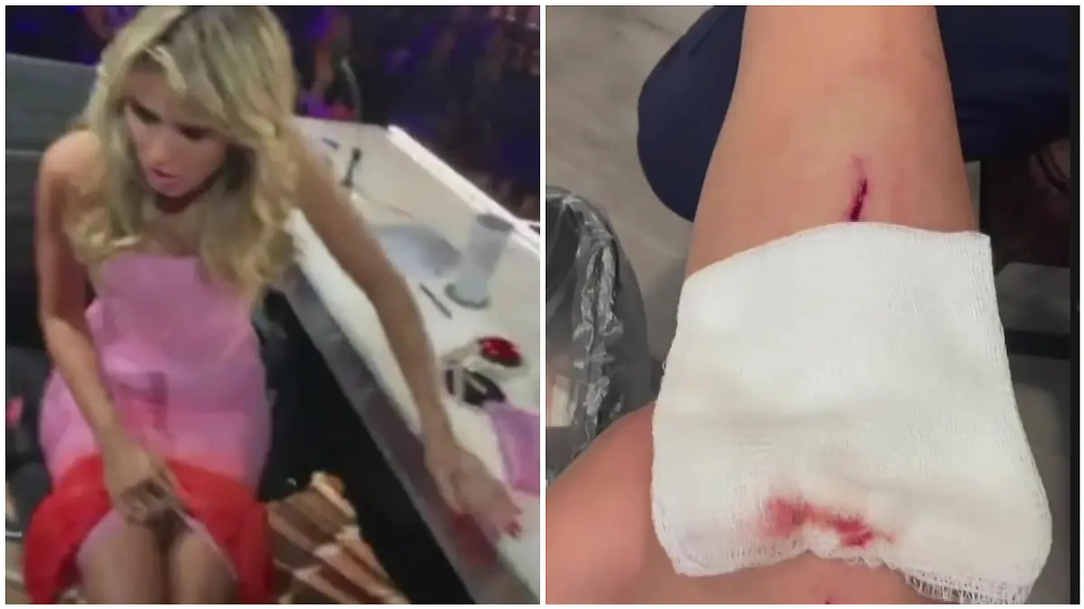 Heidi Klum zeigt ihre blutige Wunde.