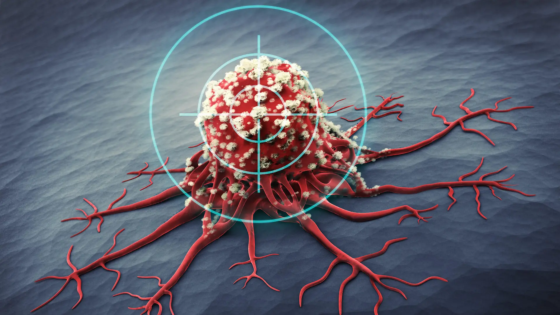 3D Rendering of a cancer cell - medical illustration