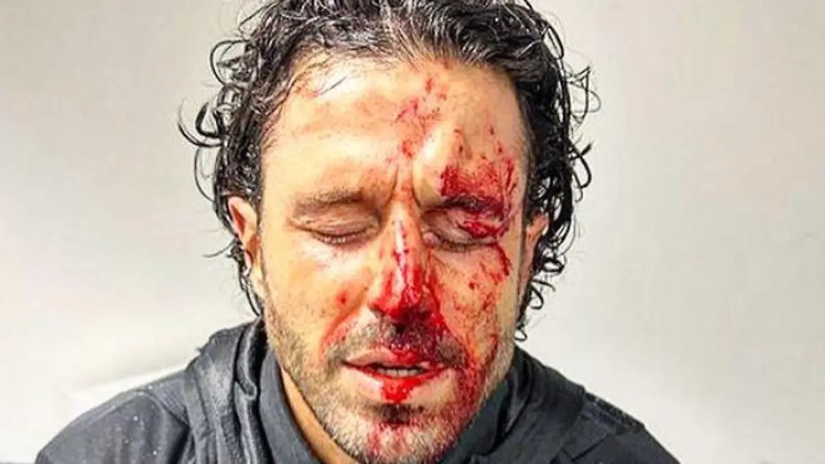 Fabio Grosso bei Fan-Attacke verletzt