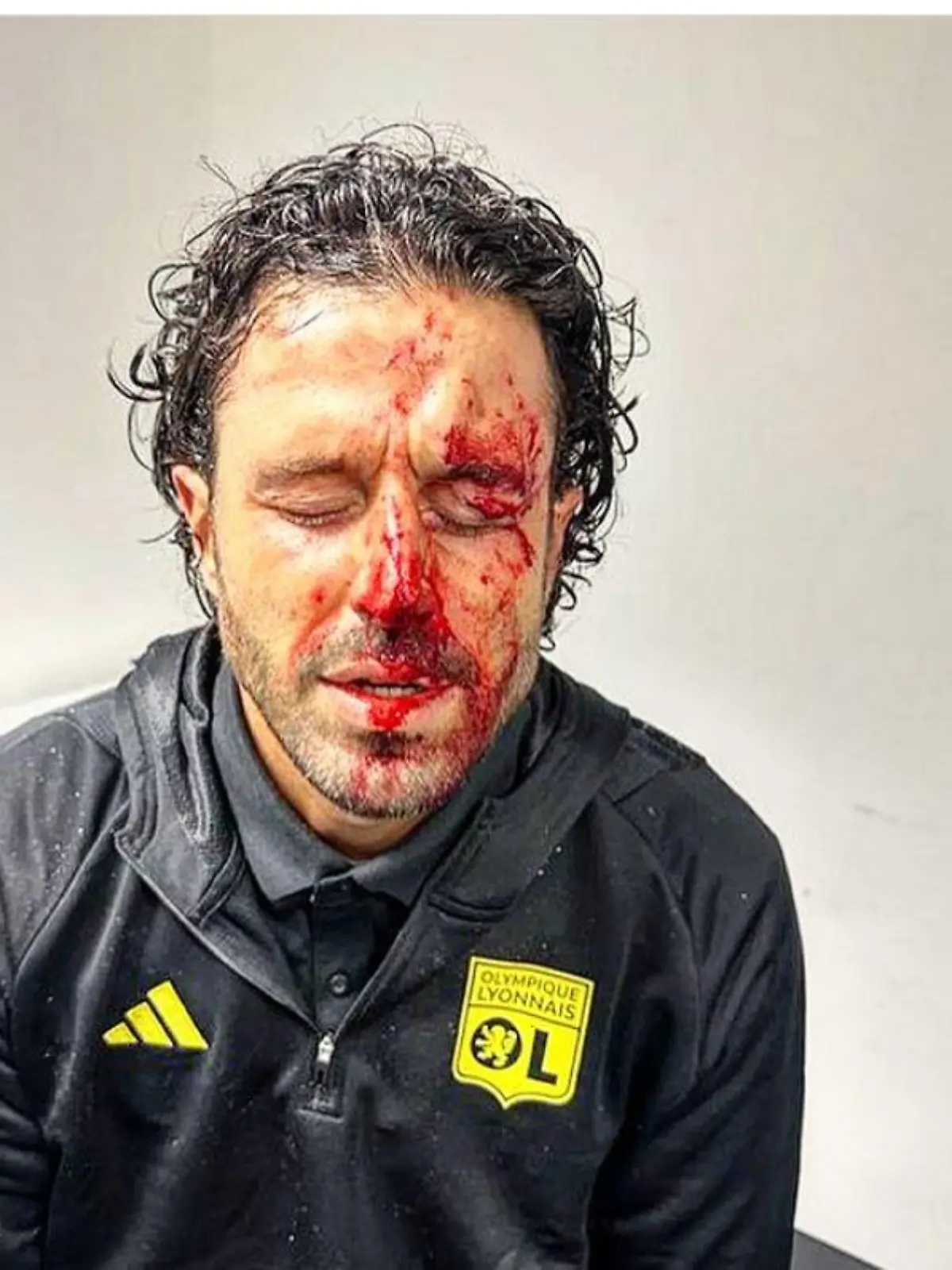 Fabio Grosso bei Fan-Attacke verletzt
