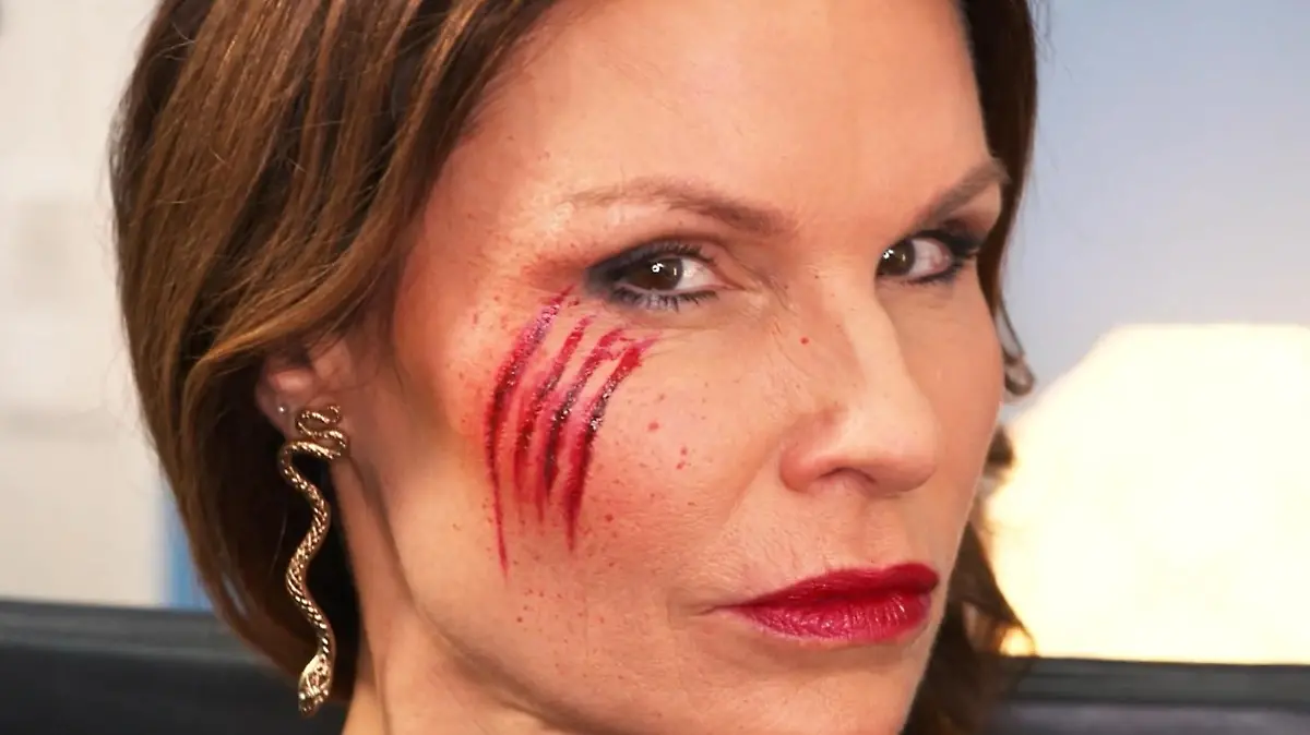 Täuschend echt aussehende Schürfwunden machen Tabea Heynigs Gesicht Halloween-tauglich, ohne dass es an Eleganz und Schönheit verliert.