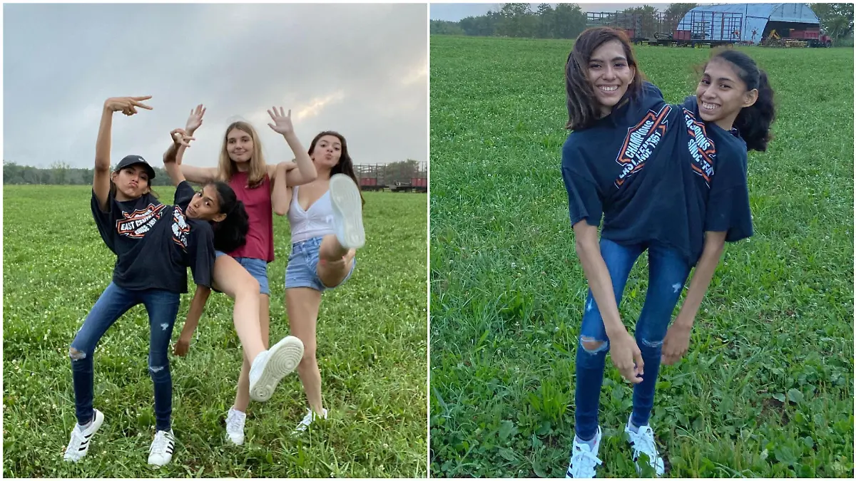 Carmen und Lupita Andrade sind siamesische Zwillinge