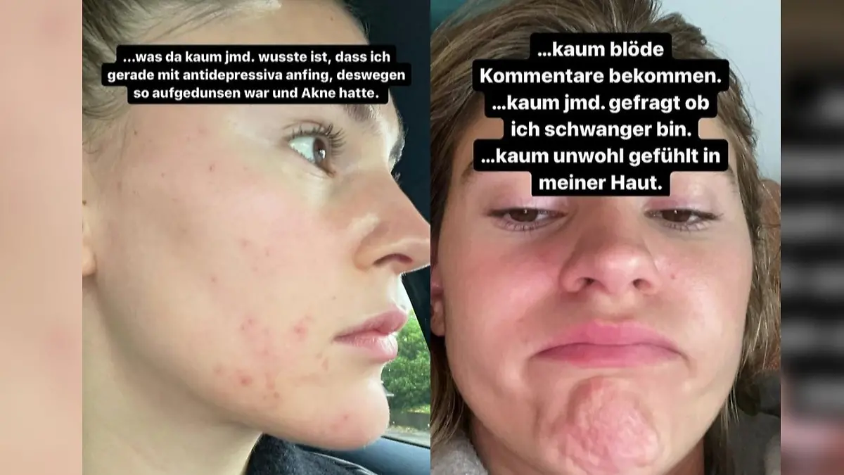 Screenshots aus Stefanie Giesingers Instagram-Story.