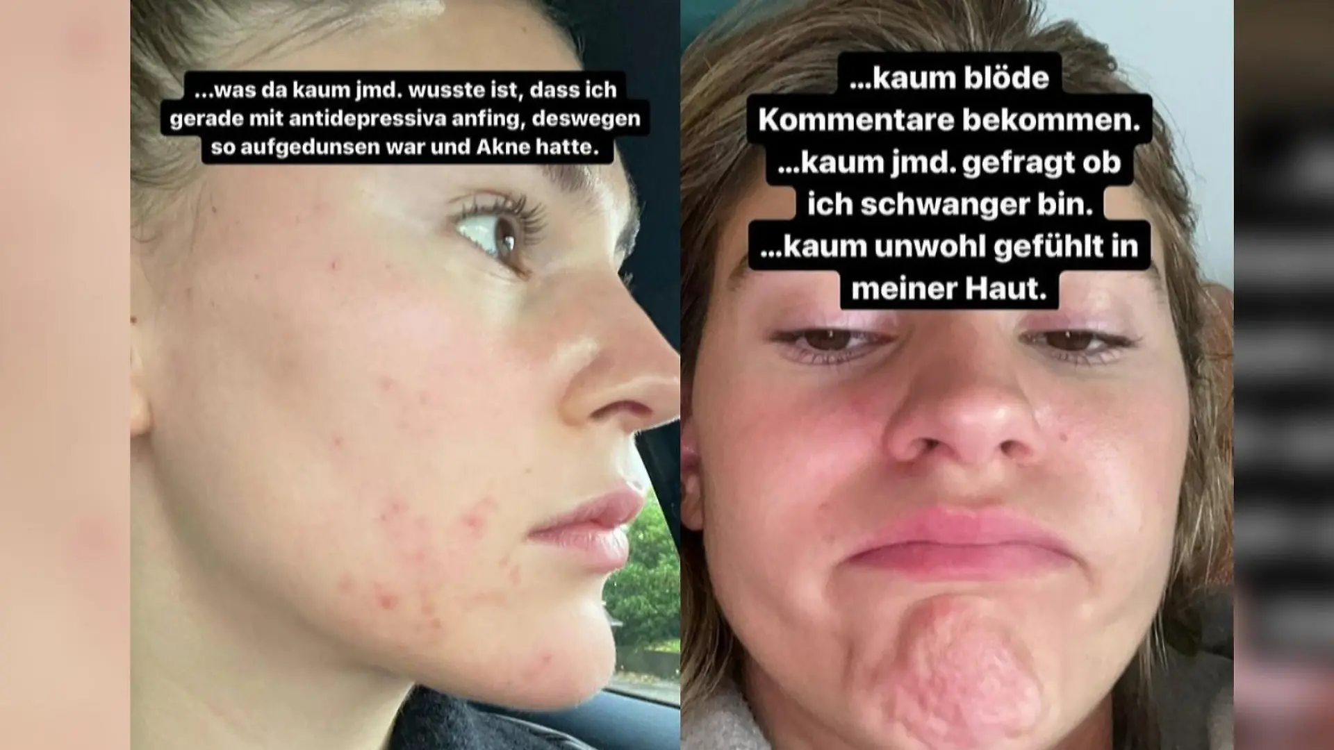 Screenshots aus Stefanie Giesingers Instagram-Story.