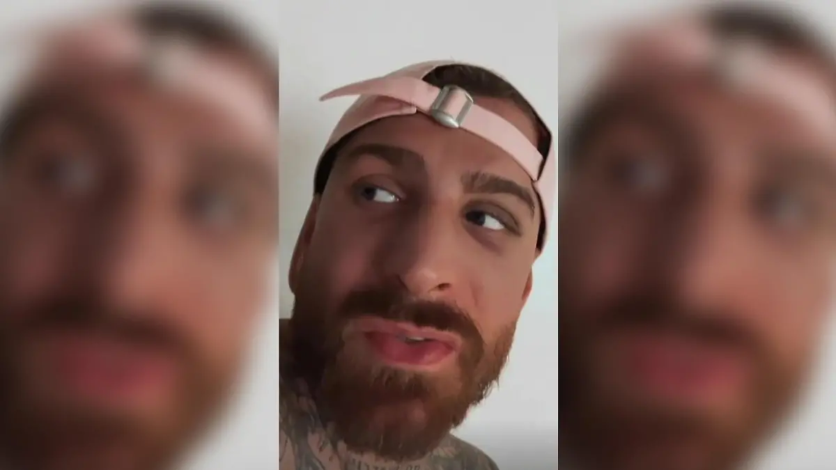 Gigis Birofios Nase ist nach dem Boxkampf gegen Can Kaplan sichtlich geschwollen.