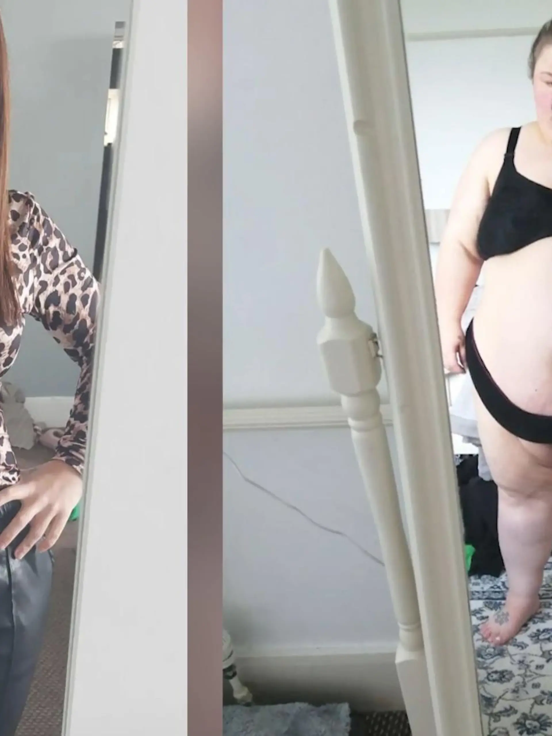 Dank einer Magenbypass-Operation im Juli 2020 verliert sie ganze 77 Kilo. Doch das brachte der 32-Jährigen das nächste Problem ein - denn die Haut hing schlaff an ihrem Körper herunter. Also entschied sich Leanne für eine Straffung am Bauch, eine Brustvergrößerung und die Entfernung der Hautlappen an Armen, Rücken und Beinen.