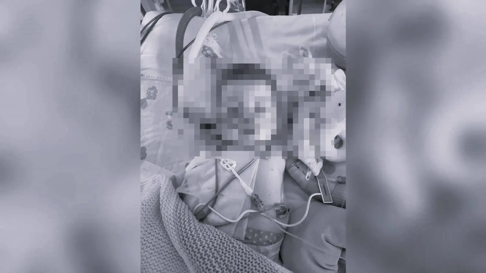 Schwerkrankes Baby Indi ist tot