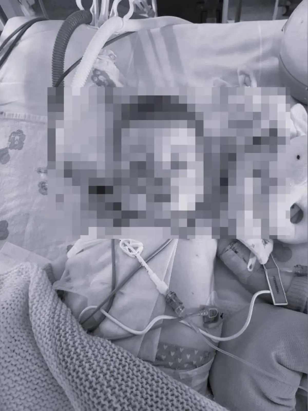 Baby Indi war schwer krank. Nachdem die lebenserhaltenden Maßnahmen für das Baby abgestellt wurden, ist es nun gestorben.