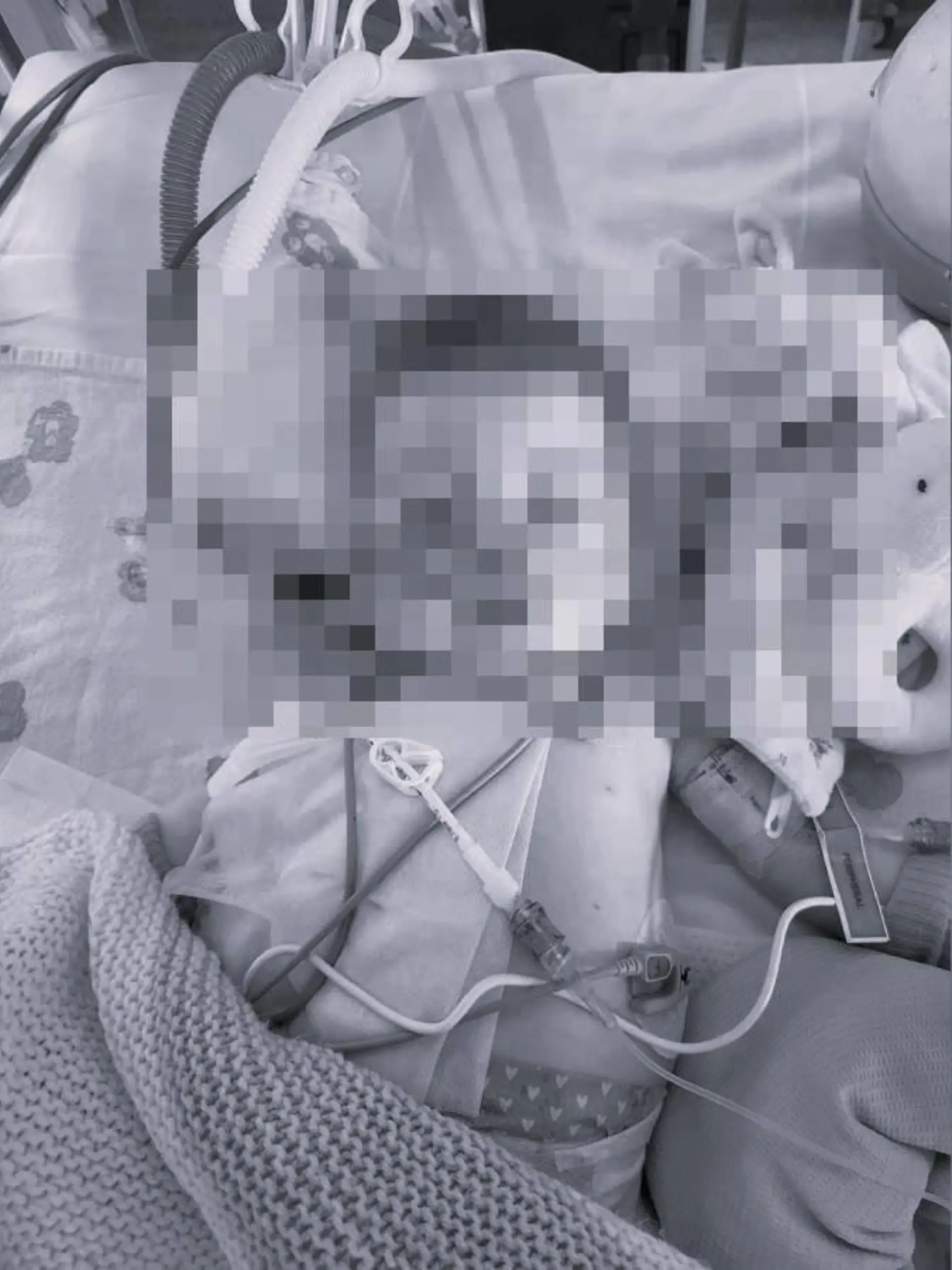 Baby Indi war schwer krank. Nachdem die lebenserhaltenden Maßnahmen für das Baby abgestellt wurden, ist es nun gestorben.