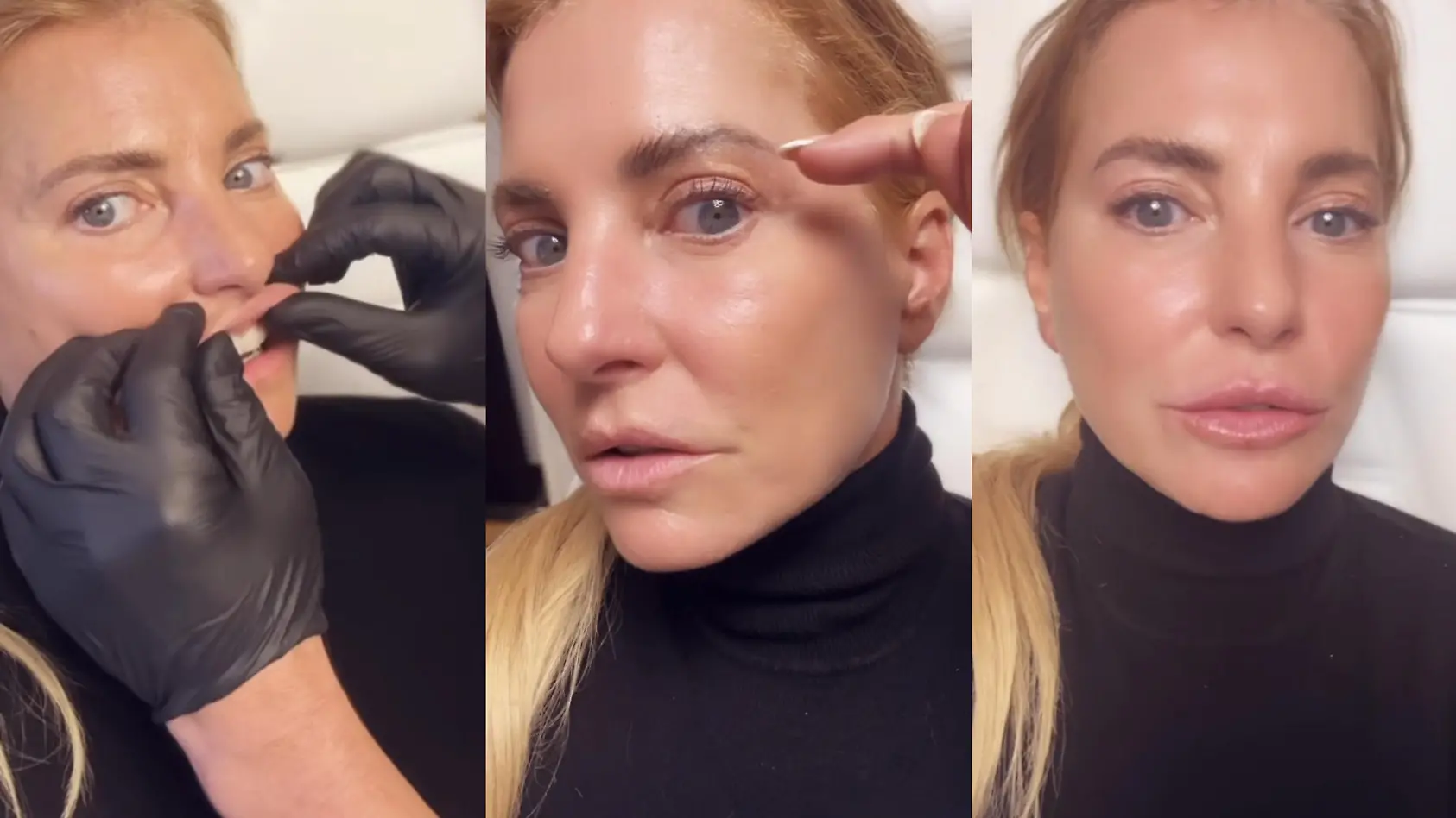 Giulia Siegel beim Beauty-Doc