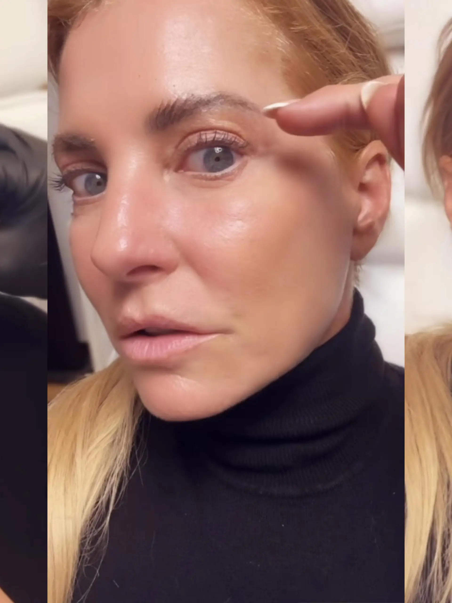 Giulia Siegel beim Beauty-Doc