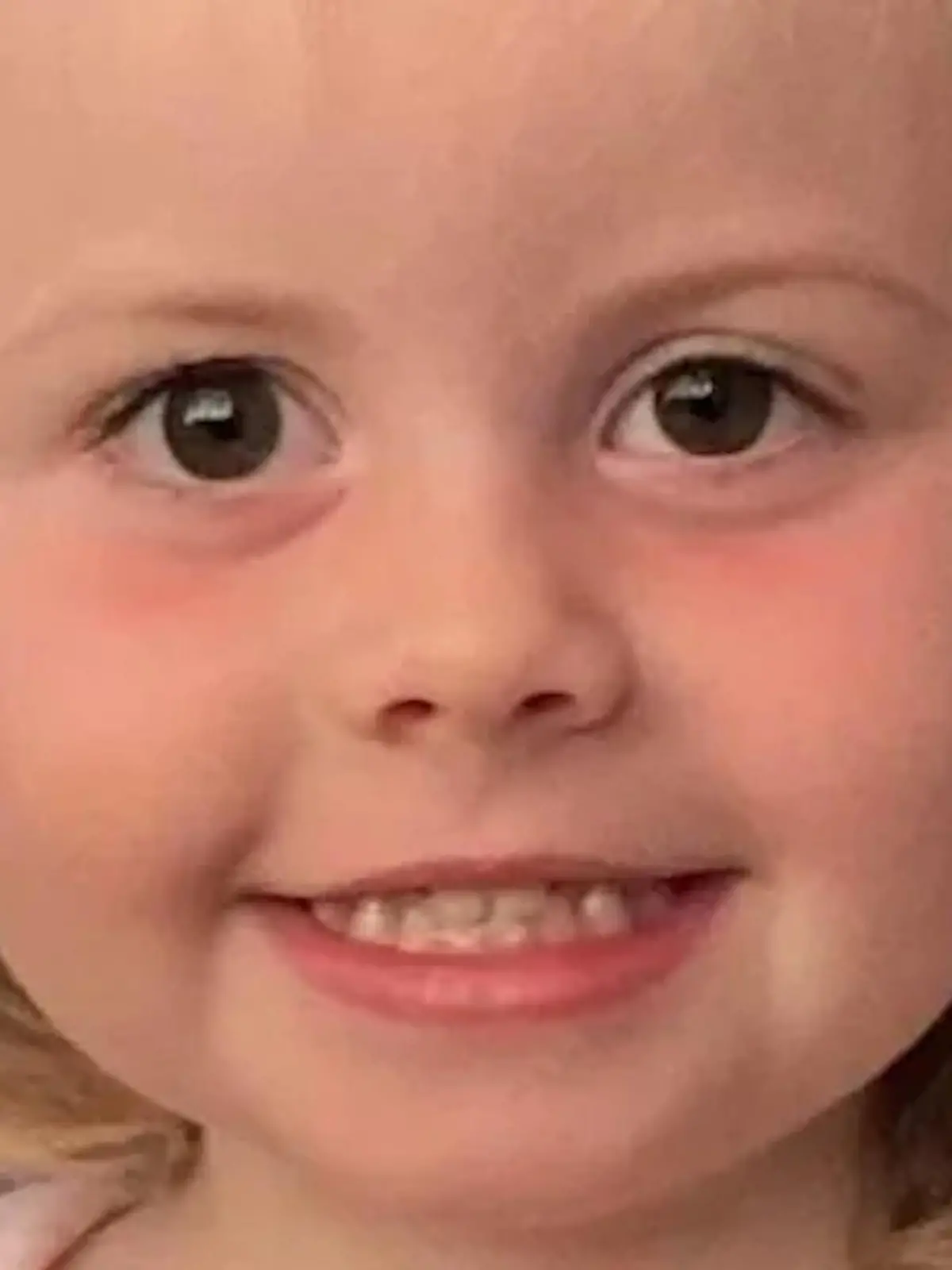 Isla (2) stirbt im Türkei-Urlaub an einer Blutvergiftung, nachdem ein Arzt ihre Blinddarmentzündung für eine Mandelentzündung gehalten hatte.