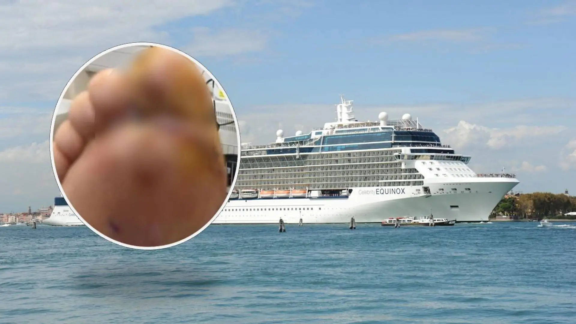 Auf einem Kreuzfahrtschiff (Symbolbild) habe ihn eine Spinne gebissen, behauptet der Mann.