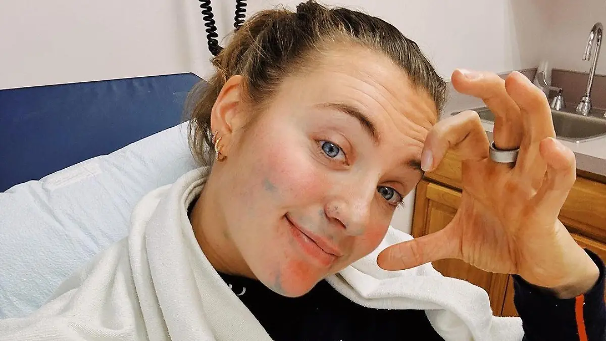 Immerhin kann sie schon wieder grinsen: Maria Tviberg fällt nach einem Sturz lange aus.