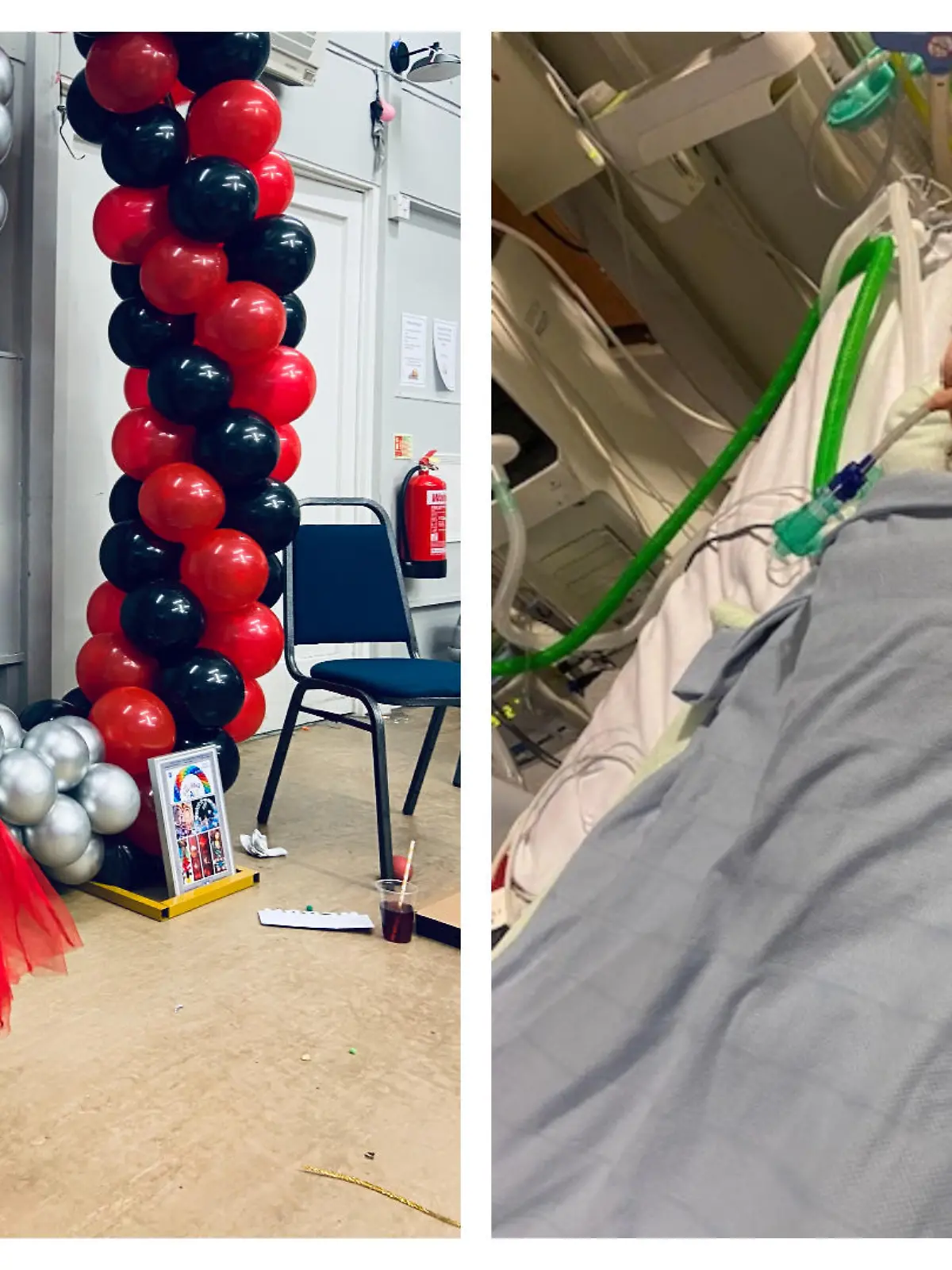 Imogen (4) bevor sie krank wurde und anschließend im Krankenhaus