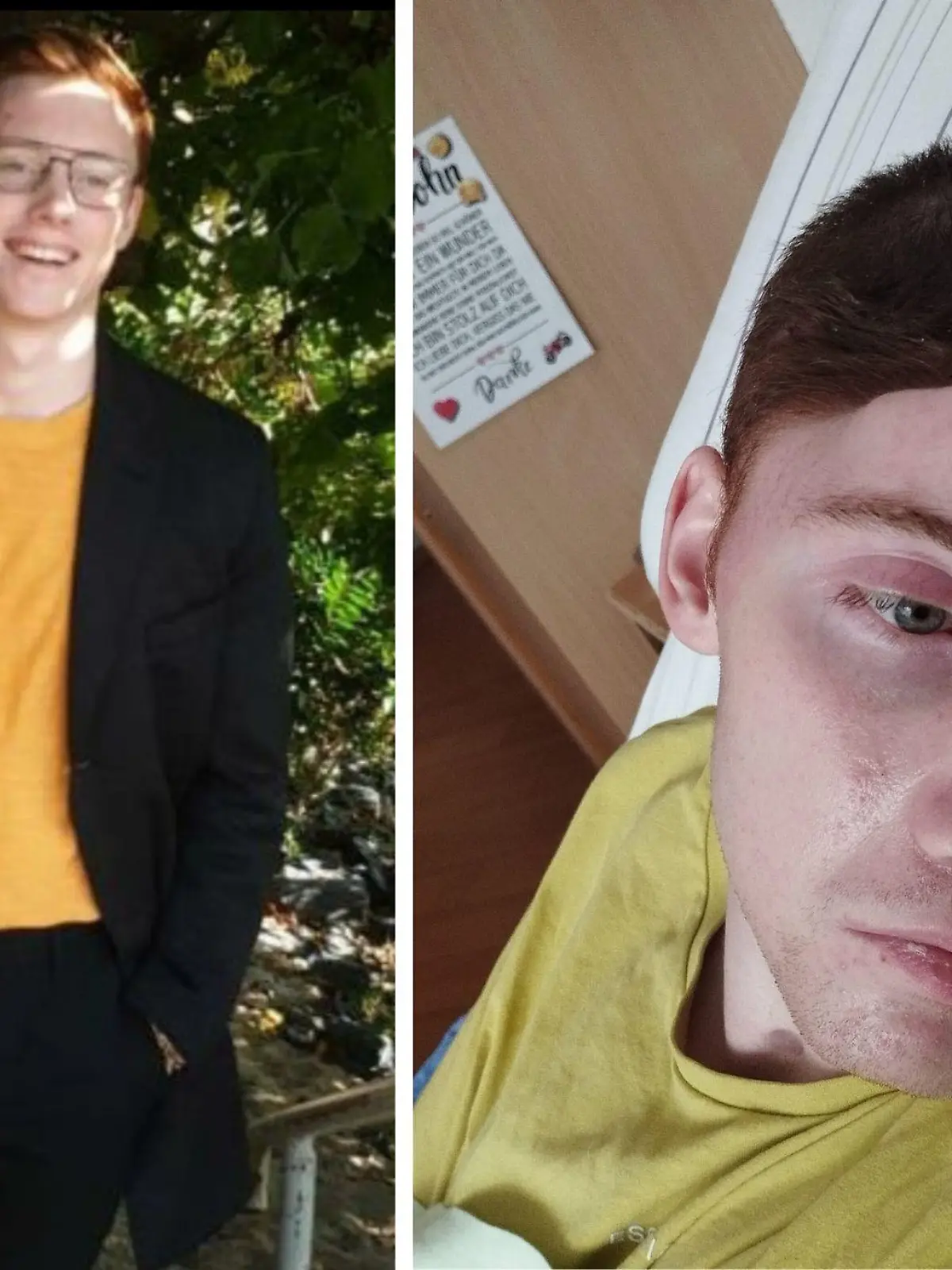 Nico vor und nach seinem schweren Motorrad-Unfall