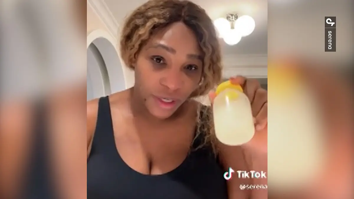 Serena Williams nutzt Muttermilch gegen Sonnebrand.