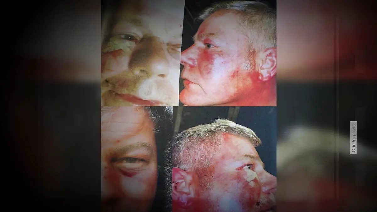 Jürgen erlitt nach dem Angriff der Polizisten schwere Verletzungen.