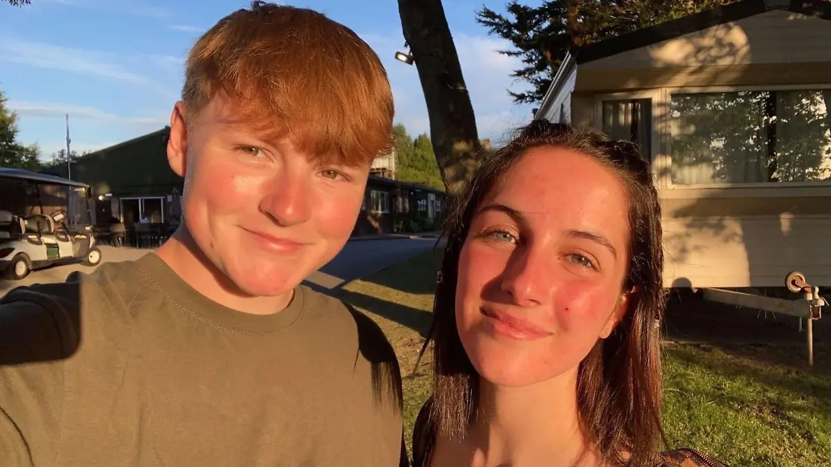 PIC FROM KENNEDY NEWS AND MEDIA (PICTURED: BETH TSANGARIDES, 20, WITH HER PARTNER OF TWO YEARS, SASHA HAY, 20) This young woman is so 'allergic to HERSELF' that even laughter can leave her looking like 'an acid attack victim' - but has finally worn makeup for the first time in years. Beth Tsangarides says her skin and body react to 'everything' she does, flaring up when she laughs or cries 'too much' and even going into anaphylaxis from many foods, herbs and spices. Horrifying photos show the 20-year-old's scorched, weeping and scabby skin that baffled docs claim is a 'medical mystery'. DISCLAIMER: While Kennedy News and Media uses its best endeavours to establish the copyright and authenticity of all pictures supplied, it accepts no liability for any damage, loss or legal action caused by the use of images supplied and the publication of images is solely at your discretion. SEE KENNEDY NEWS COPY - 0161 697 4266