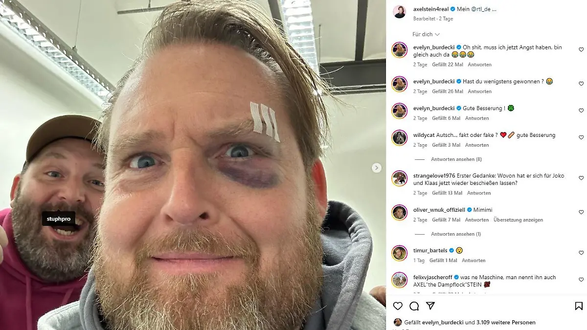 Autsch! Das sieht gar nicht gut aus, was Schauspieler Axel Stein da auf seinem Instagram-Kanal postet.