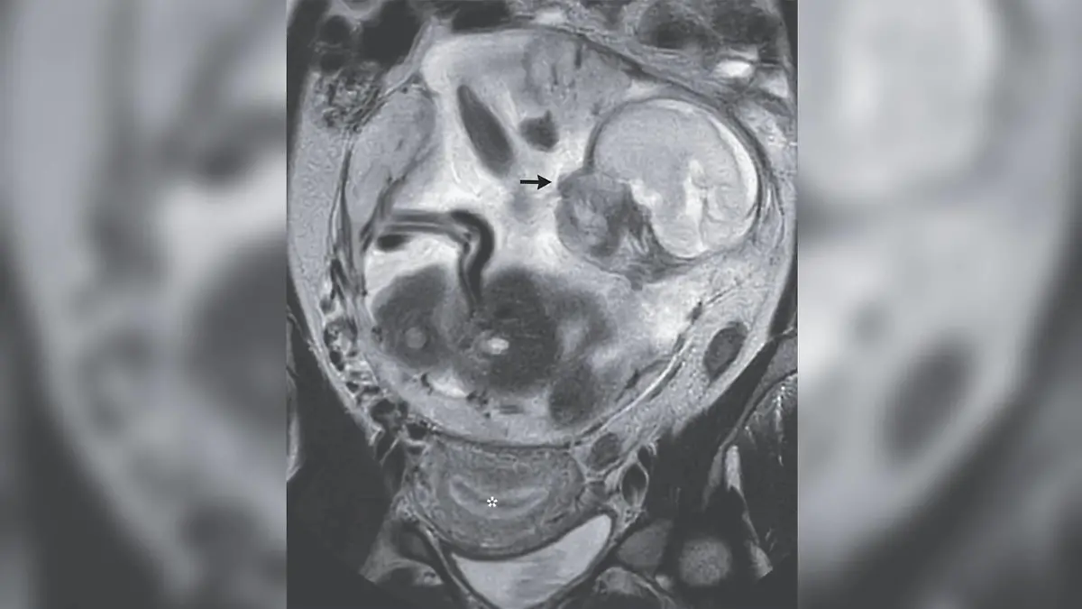 Ultraschallbild