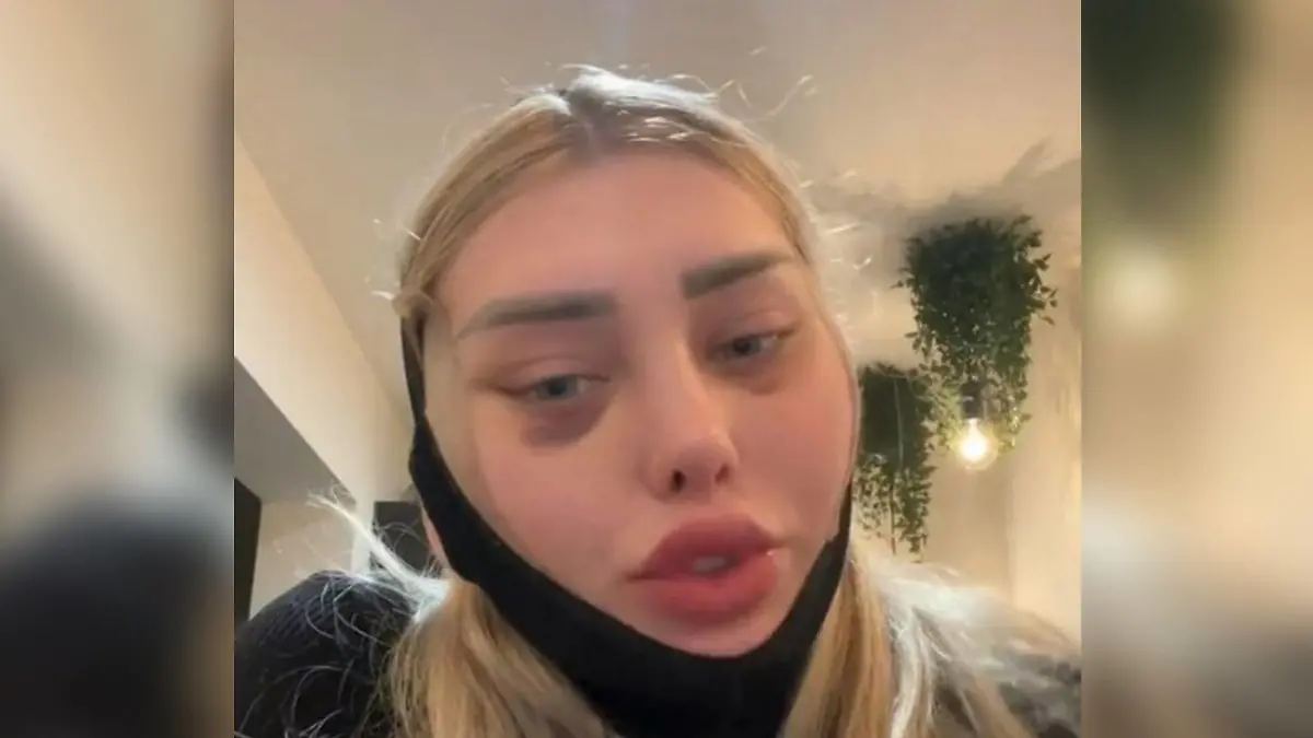 TikTok-Userin Weronika erzählt, wie ihr Kopf an Bord eines Flugzeugs "explodierte".